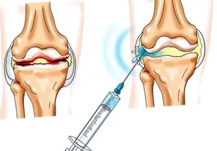 степен коляно