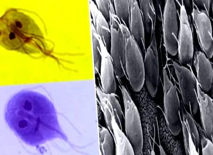 giardiasis viermi