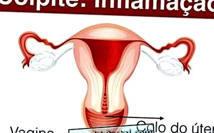 tratamentul pentru