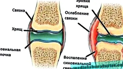 облекчим ставите