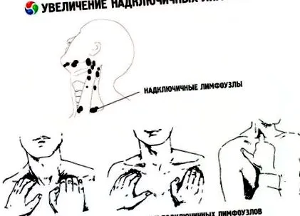 цервикална цервикална