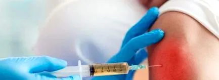 колянната хирудотерапия