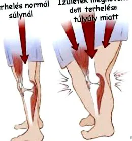 afectează