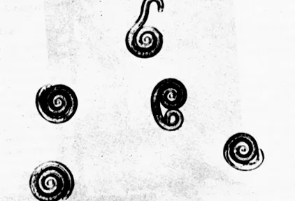 trichinella