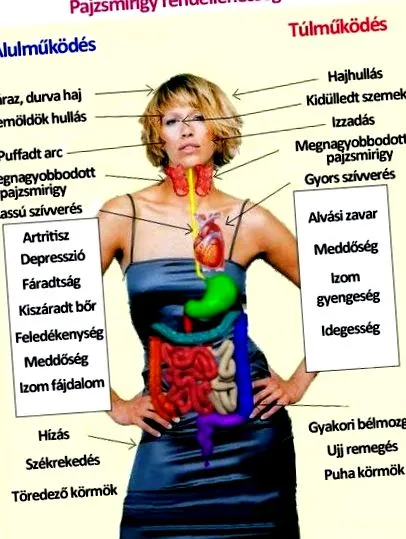 hipotiroidism artrita