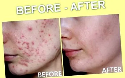 kbeauty това