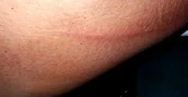 костите костите