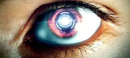 implant implant