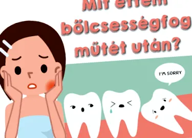 мудрості операції