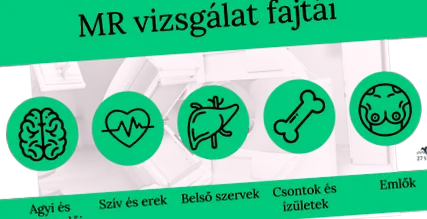 изследването вида