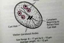 giardiasis giardia