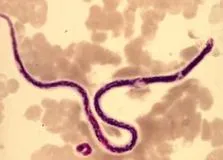 protozoa protozoa