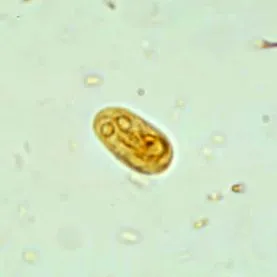 quiste giardia