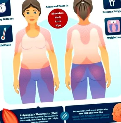 rheumatica rheumatica