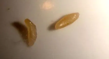 лечение лечение