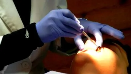 dentpoint рани