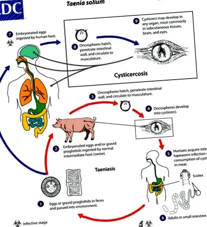 Giardia lamblia анемія