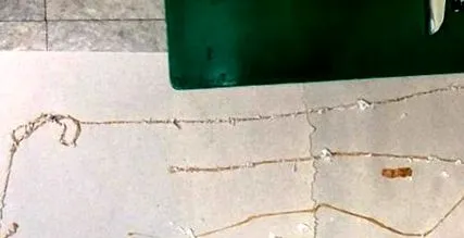 лікування уреаплазмозу