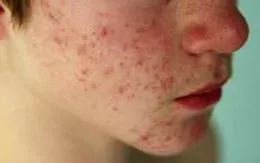 може бъде visage