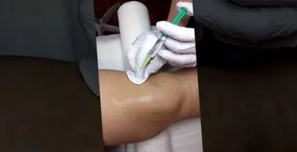 зонотерапия колянната