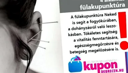 акупунктури акупунктури