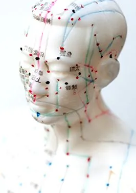 acupunctura Acupunctura Unde