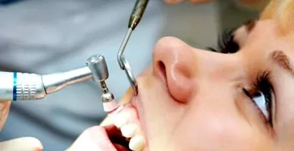 natural dental