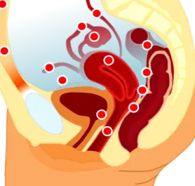 endometrioză terapia hormonală