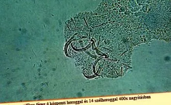 възрастни лечение