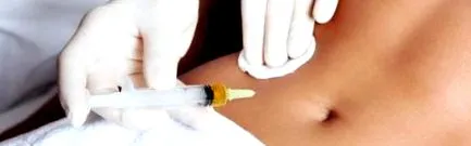 лимфна отслабване