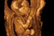 3D УЗД плоду при вагітності в Любліно, АГАПЕ -Медичний центр у Любліному агапе