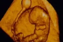 3D УЗД плоду при вагітності в Любліно, АГАПЕ -Медичний центр у Любліному любліно