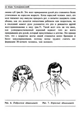 Алан Піз та Мова жестів мова