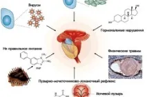 лечение лечение