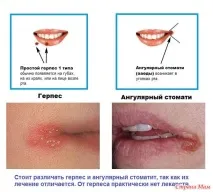 бързо бързо