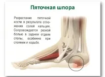 болки краката