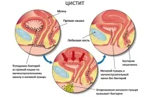 симптоми