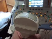 Дефекти датчиків УЗД, Broadsound broadsound