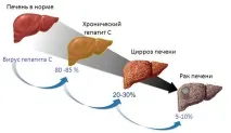симптоми