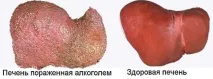 чоловіків
