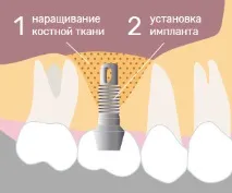 зъбна зъбна
