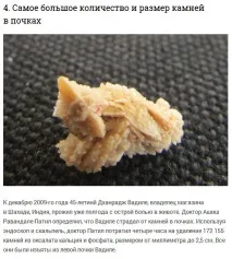 Як потрібно харчуватися щоб уникнути утворення каменів у нирках харчуватися