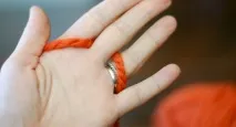 ечемика очите
