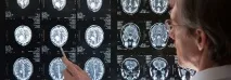 Як у Китаї лікують хвороби ЦНС особливості методики особливості