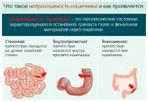 чревна чревна
