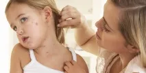 петна лицето
