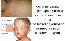 симптоми изборът