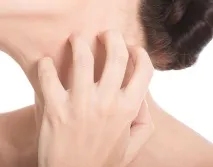 aloderm лечение