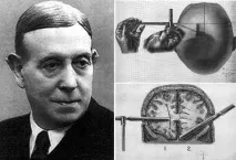 lobotomy lobotomy