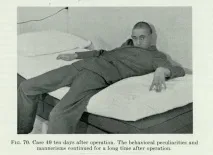 lobotomy снимки